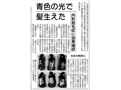健康な毛髪の維持に欠かせないIGF-1を効果的かつ効率的に増加させる 最先端のケア器具『AGAIA  BLUE』を販売開始