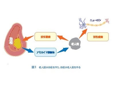 脳の栄養失調に要注意  ゴマなど、抗酸化食品の摂取も重要