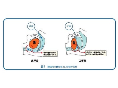 花粉症シーズンもQOLを低下させない。　ポイントは“眠気の軽減”