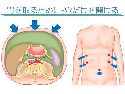 医師向けiPadアプリ（3.7万DL実績）活用で、日本初の本格的な患者説明スライド無料「ライブラリ」を開始～医療現場の悩み「時間不足の医師」「もっと説明を受けたい患者」を解消～