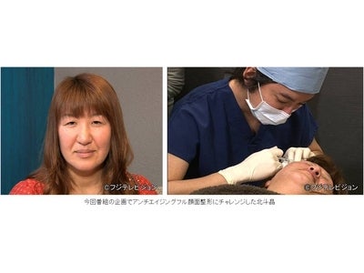 【フジテレビ】北斗晶がアンチエイジング顔面フル整形に挑戦！ 『なかよしテレビ～日中韓アジアライバル3カ国～ 整形から子役まで本気で戦うぞSP』放送 明日3月23日（金）午後7時～8時54分
