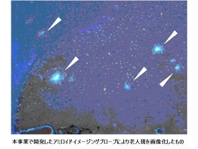 アルツハイマー病の早期診断を可能にする老人斑アミロイドの分子イメージング技術【産技助成Vol.28】