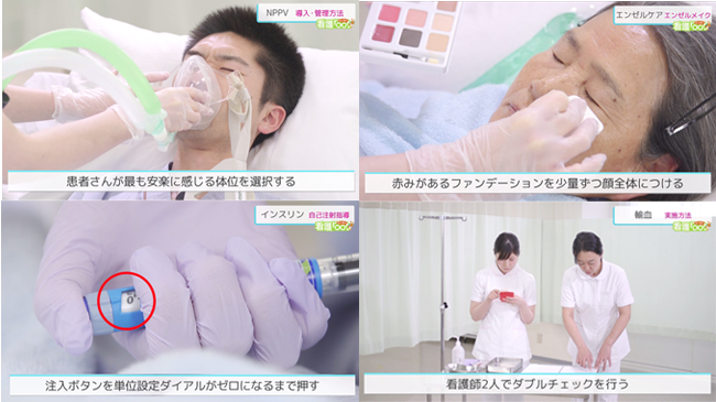 看護技術が無料で学べる動画サイトに新規動画追加 のべ300本の動画が見放題に Cnet Japan