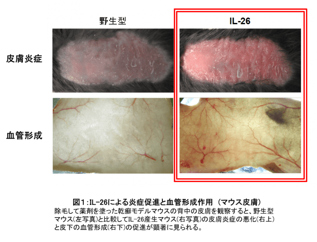   図１：IL-26による炎症促進と血管形成作用　(マウス皮膚)