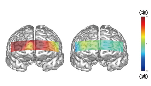 会話中の脳のヒートマップ（左）自分に合っていない眉（右）自分に合った眉