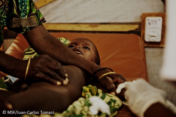 MSFによる治療を受けるニジェールの重度栄養失調児。この国のハンガーギャップ期（6－9月）における栄養失調は深刻だ（2012年8月撮影）