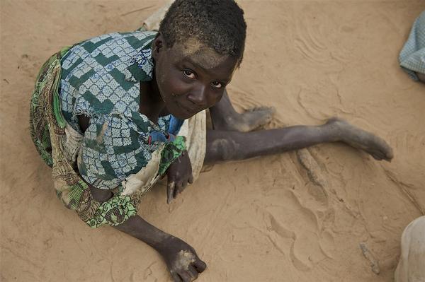 © UNICEF/MLWB2010-331/SHEHZAD NOORANI 知的障がいのあるマラウイの女の子。