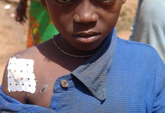 Baoroの避難所で治療を受けた男の子。　©UNICEF.CAR/2014/Rebillon