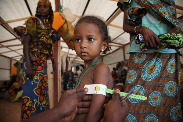 栄養状態の検査を受ける女の子 © UNICE/NYHQ2014-0401/Roger LeMoyne