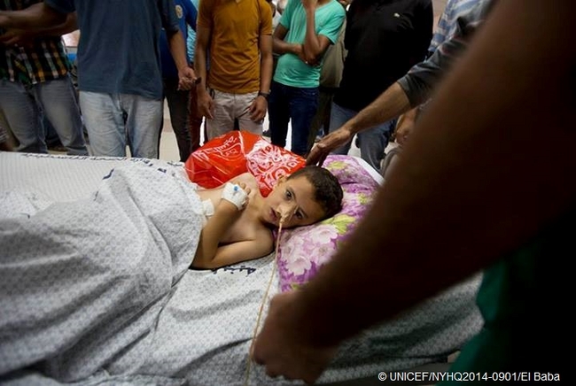 病院で治療を受ける、5歳のキナンくん。© UNICEF/NYHQ2014-0901/El Baba