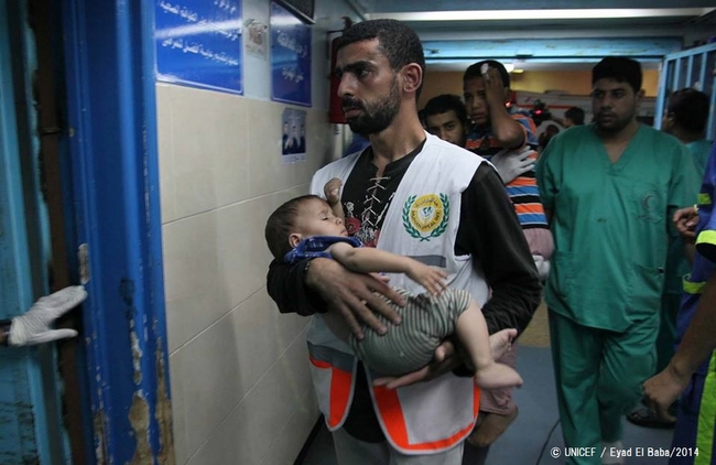 空爆で負傷した子どもを運ぶ医者。子ども35人が死亡、少なくとも296人が負傷した（7月14日時点）© UNICEF / Eyad El Baba/2014