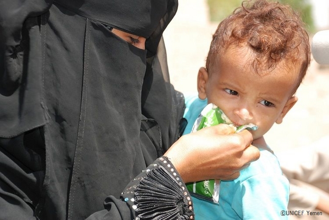 栄養不良の子どもに、すぐに口にできる栄養治療食を与える母親。©UNICEF Yemen