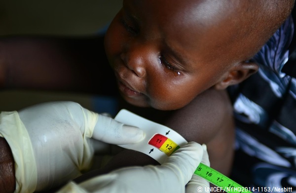 上腕の周囲を測り、栄養状態の検査を行う様子。赤色は栄養不良の可能性がある、危険な状態を示す。© UNICEF/NYHQ2014-1153/Nesbitt