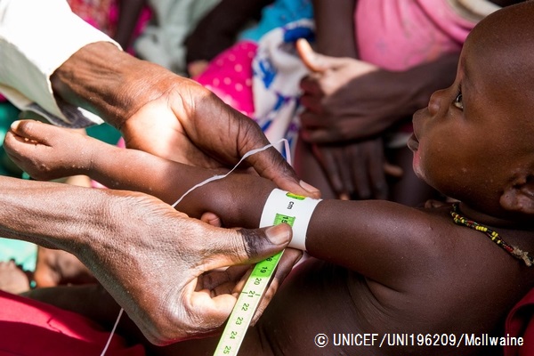 ユニセフとWFPによる合同の栄養支援で、栄養状態の検査を受ける子ども。© UNICEF_UNI196209_McIlwaine