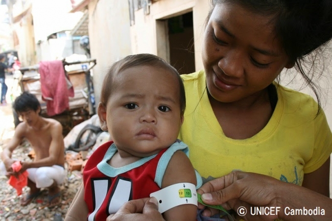 栄養状態の検査を受ける赤ちゃん。（カンボジア）© UNICEF Cambodia