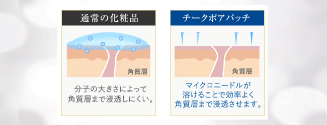 新商品 頬 の 毛穴 専用マイクロニードル美容商品 チークポアパッチ 株式会社 北の達人コーポレーションのプレスリリース 新商品 頬 の 毛穴 専用マイクロニードル美容商品 チークポアパッチ 株式会社 北の達人コーポレーションのプレスリリース