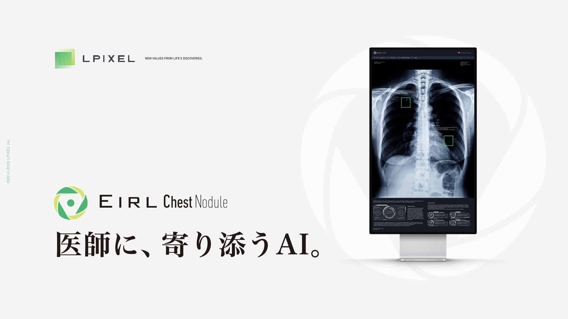 胸部x線画像から 肺がん が疑われる肺結節候補域を検出する 医用画像解析ソフトウェア Eirl Chest Noduleを発売 Lpixelのプレスリリース