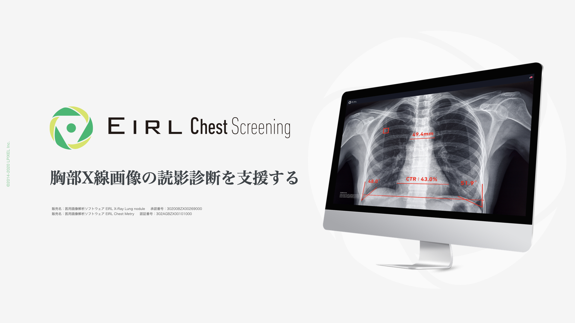 胸部X線画像の読影診断を支援するEIRL Chest Screening、肺結節候補域の検出と5つの計測機能を有する新モデルとして販売開始