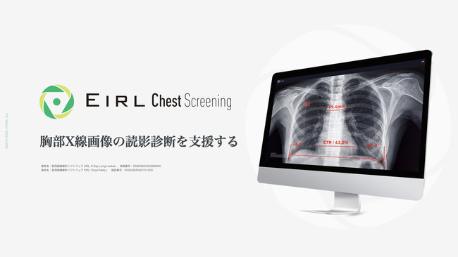 胸部X線画像の読影診断を支援するEIRL Chest Screening、肺結節候補域 