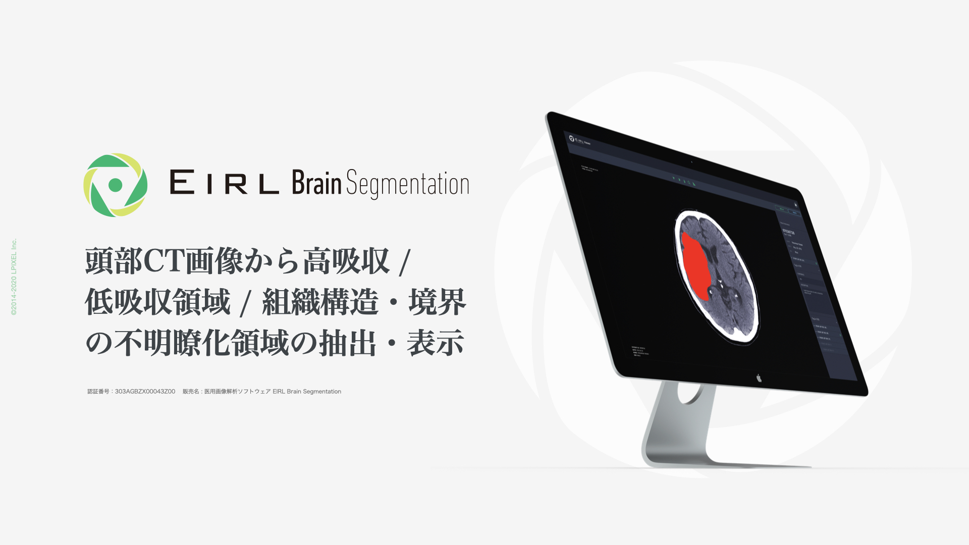 EIRL Brain Segmentation、頭部CT画像から高吸収/低吸収領域及び組織構造・境界の不明瞭化がみられる領域の抽出・表示が可能となった新モデルをリリース