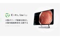大腸内視鏡診断支援AI「EIRL Colon Polyp」が診療報酬の加算対象に