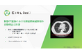 胸部CT画像から「肺がん」が疑われる肺結節候補域の検出を支援するEIRLChest CT、薬事承認を取得し販売開始