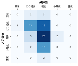 運動障害スコアの人的評価とAI評価の比較の一例