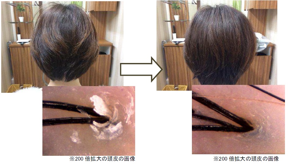 抜け毛 敏感肌 くせ毛 細毛 髪と頭皮の悩みを 水 が解決 株式会社バイオテックのプレスリリース