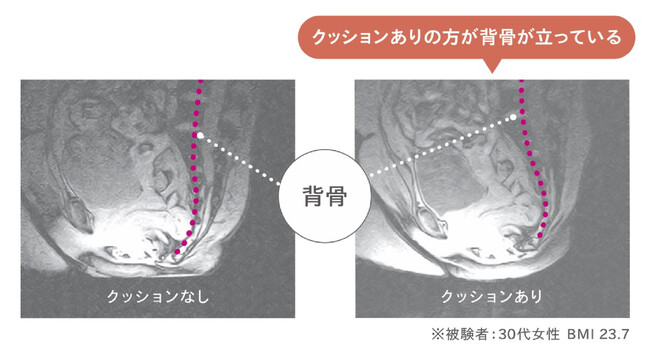 骨盤ホールド 検証結果 骨盤ホールド 検証結果