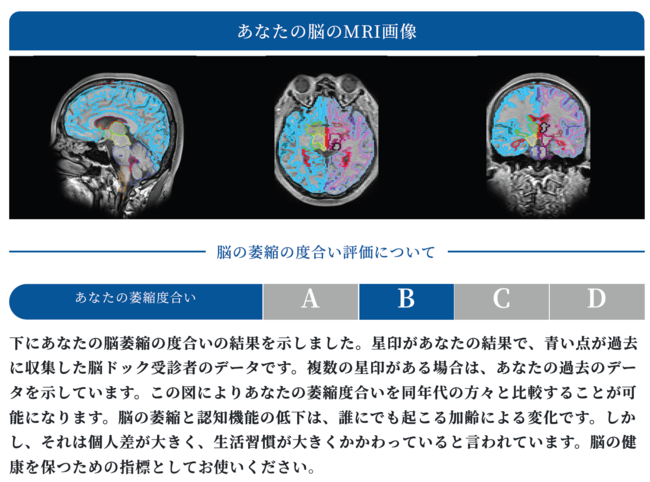 脳のMRI画像から画像解析により萎縮度合いを総合評価。これに加えて脳血管の健康度も総合評価する 脳のMRI画像から画像解析により萎縮度合いを総合評価。これに加えて脳血管の健康度も総合評価する