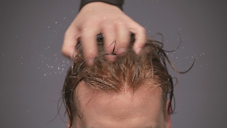 アデランス北米グループ ヘアクラブ社の技術を応用した新増毛ヘアシステム 自由な髪 がテーマの フリーダム 誕生 株式会社アデランスのプレスリリース
