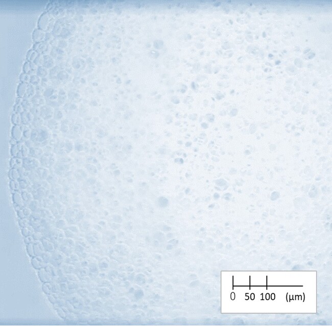 アワニスト スカルプシャンプーを『AWANIST』を使用して作った泡 （顕微鏡画像）