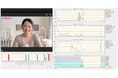 「Teladoc HEALTH」×表情解析AIシステム、NICUにおけるオンライン親子面会の試験運用を開始