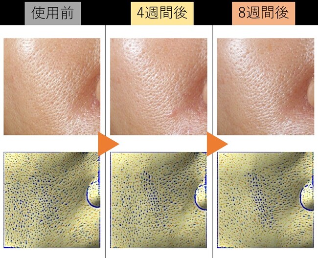 (図3．写真およびANTERA 3Dのイメージング解析による毛穴の変化の様子)