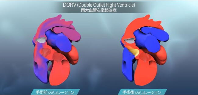 (C)HPCI戦略プログラム 分野1理化学研究所 (C)HPCI戦略プログラム 分野1理化学研究所