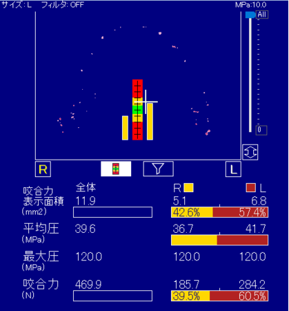 選手Bさん　測定結果 １.：469.9N ２.：左60.5%、右39.5%