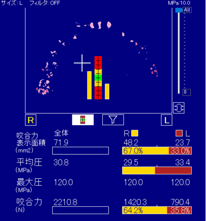 選手Cさん　測定結果 １.：2210.8N ２.：左35.8%、右64.2%