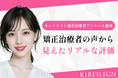 【矯正治療者アンケート】　キレイライン矯正治療者の96%が「満足」と回答。実際に良かった点とは？