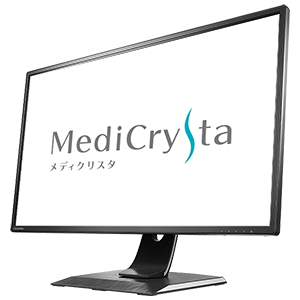 医療画像参照に適した3 6mpの高解像度 Dicomカーブ対応の液晶ディスプレイ Medicrysta メディクリスタ 登場 株式会社アイ オー データ機器のプレスリリース