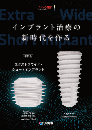 日本初の販売認可取得】直径7.0mm以上のインプラント「AnyOne 