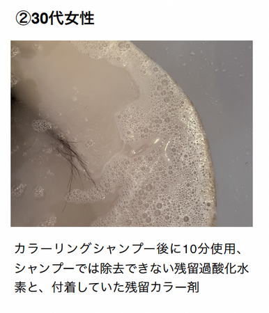 高濃度水素マイクロナノバブルシャワー