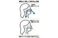 「医学の死角。血糖値・中性脂肪は“睡眠中の酸素不足”では下がらない。・・・解決策（新発見）」