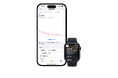 Apple Watchを活用した心房細動治療の新たな研究に着手
