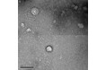 発酵から生まれた植物性発酵物由来エクソソーム様構造体の含有を発見!!