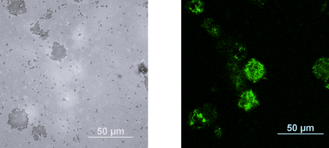 図3　粗大気孔を有する窒化ケイ素の金属顕微鏡を用いた反射像（左） 左図と同じ箇所を、レーザーを用いた蛍光顕微鏡で観察した、表面から約3µm下の蛍光像（右）