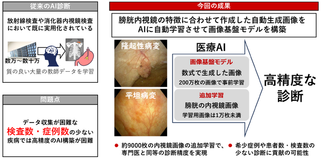 図1　画像基盤モデルを活用した膀胱内視鏡診断支援AIの構築