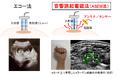 新技術ASEM法による超音波画像化の革新。線維の配向度を精密に評価可能とする技術を解説