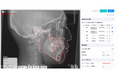 AIが矯正歯科の「重ね合わせ」解析を完全自動化　クラウド型AIセファロ分析システム「DIP Magic Compare™」正式リリース