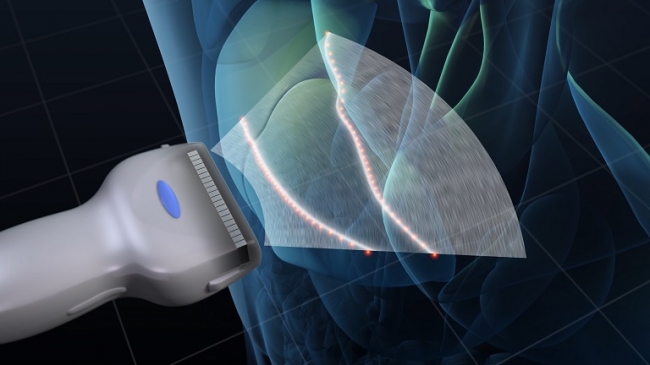 キヤノンが 超音波診断装置 の技術紹介動画を公開 キヤノン株式会社のプレスリリース