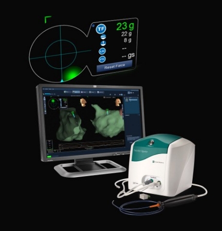 セント ジュード メディカル 心房細動の治療に使用するtacticath Quartzコンタクトフォースアブレーションカテーテルを日本で上市 アボットのプレスリリース